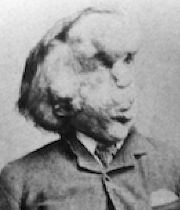 Joseph Carey Merrick's Memorial