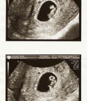 baby baccous  's Memorial