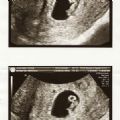 babybaccous's Online Memorials