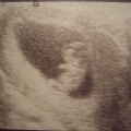 MISSINGYOUBABY's Online Memorials