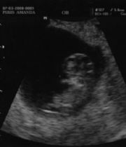 Kaden Lynn McPherson's Memorial