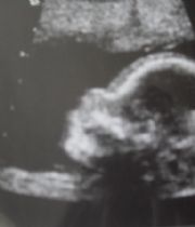 Aiden Mitch Garcia Aiden Mitch Garcia