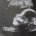 aiden-mitch-garcia's Online Memorials
