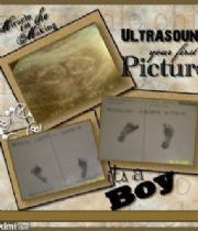 Anthony Watson Anthony Watson