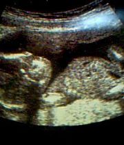 Baby Junior  Denton's Memorial