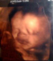 Asher Anthony (Our Sweet Baby Boy) Robba's Memorial