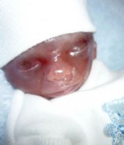 Alexander Thompson Alexander Thompson