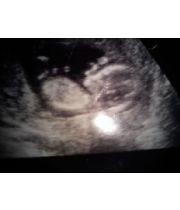 Lee Catley Lee Catley